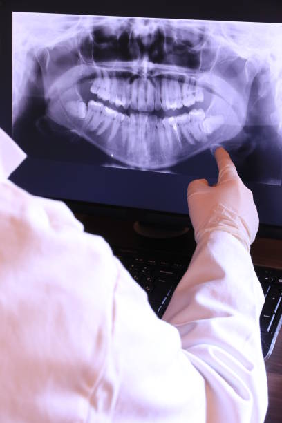 Best Knocked-Out Tooth (Avulsed Tooth) Treatment in Laughlin, NV